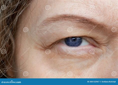 middle aged female  eye  drooping eyelid making eyebrow makeup