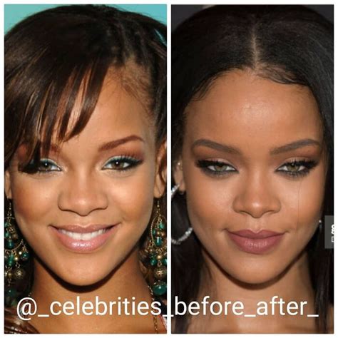 Nucelebs: Before & After Photos You Have To See! - add1nsn