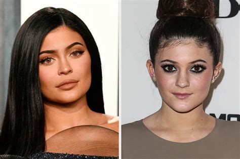 Kylie Jenner Before And After