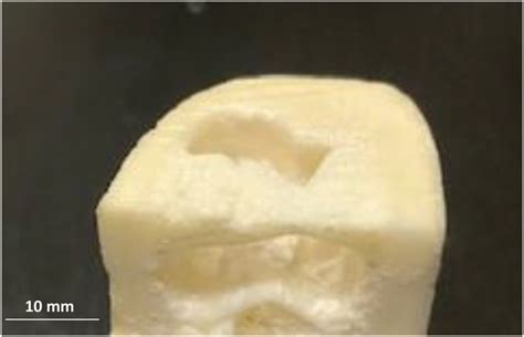 photographic image   defected mandibular bone