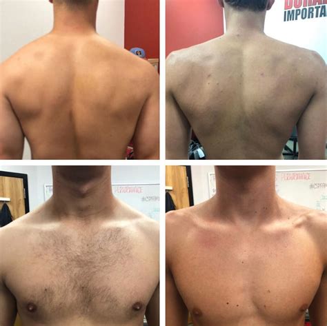how to know if you have broad shoulders