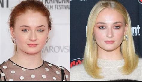 Sophie Turner Plastic Surgery: Did She Have Any Cosmetic Enhancements ...