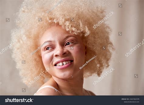 1,017 Albino Black Woman Images, Stock Photos, 3D objects, & Vectors ...