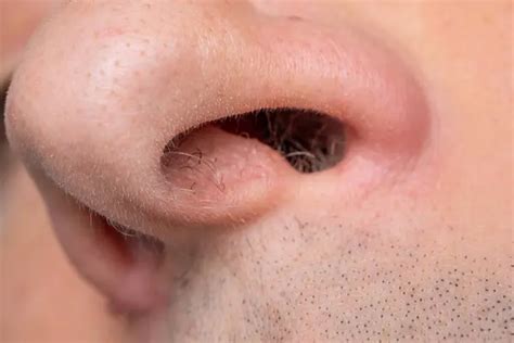 how to open up your nose