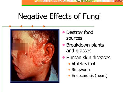 PPT - Fungus: PowerPoint Presentation, free download - ID:138451
