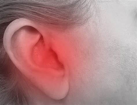 Shooting Pain From Ear To Head at Julie Clay blog