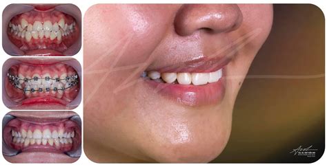 dr ngo tuan anh dds msc  orthodontics germany facebook