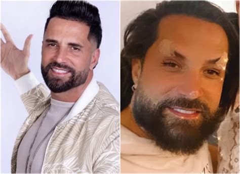 Latino Antes E Depois