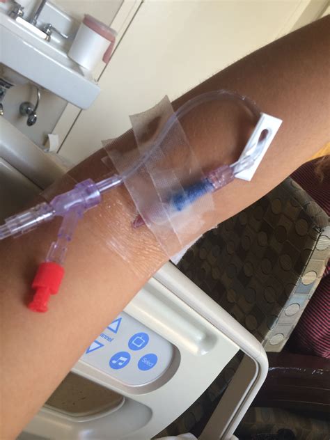 Quanto Tempo Leva Para Tomar 500ml De Soro Na Veia - Imagem Tomando Soro Na Veia - RETOEDU