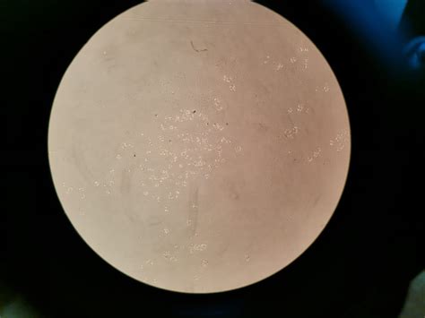 formation  foci   foci forming assay researchgate