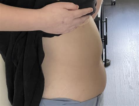 does my stomach look weird? : r/medical_advice