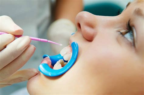 Protect your Child’s Teeth | Eastlake Family Dentistry