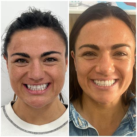 brite smiles of rhode island 7