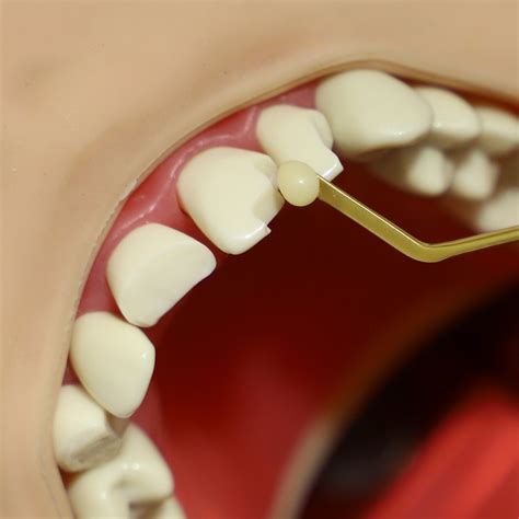 prep teeth  dental pty