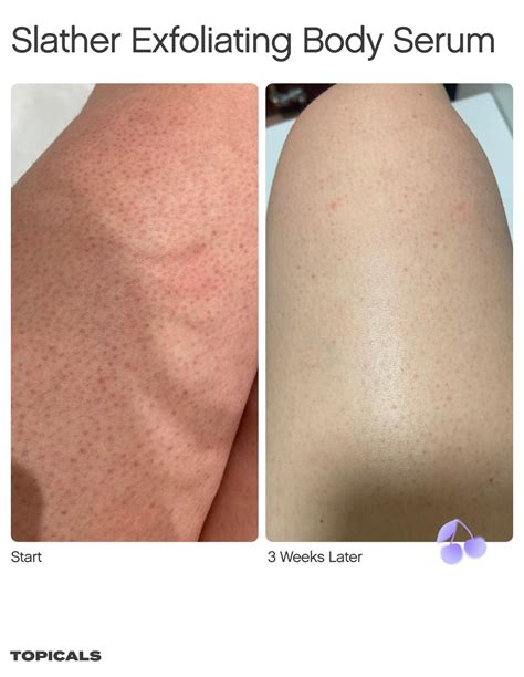 Skincare Products For Women - Skincare | Topicals
