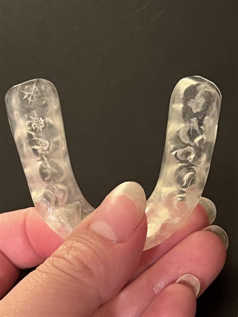 Major cracks/fissures in my splint after only having for it 3 months