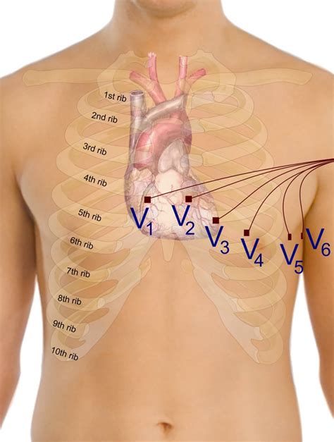 Electrocardiography (ECG) — Medistudents