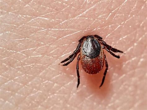 tick bite treatment  step  step care guide
