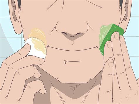 Tratamentos Para Dermatite Perioral - RETOEDU