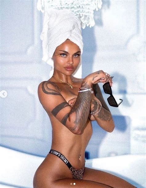 Kamila Smogulecka İyileşme Sürecini Anlattı - Onedio