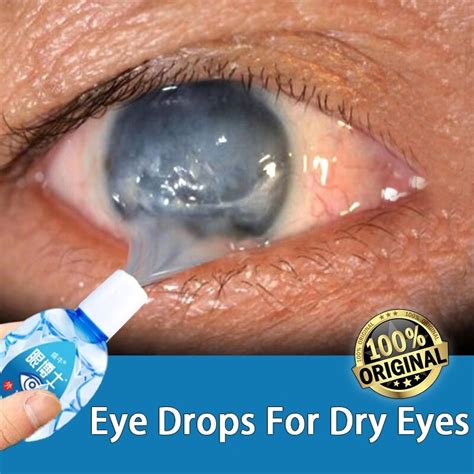 Eye drops for dry eyes eye drops for blurred vision eye drops for ...