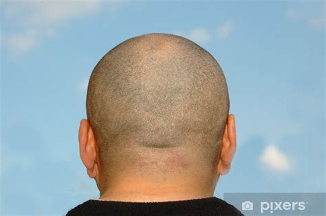 fototapeta tete de dos pixerscz