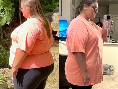 Before and after semaglutide: 6 people on the 'game-changer' weight ...