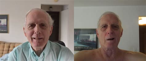 Just me, trying to make it through life: Bell's Palsy.