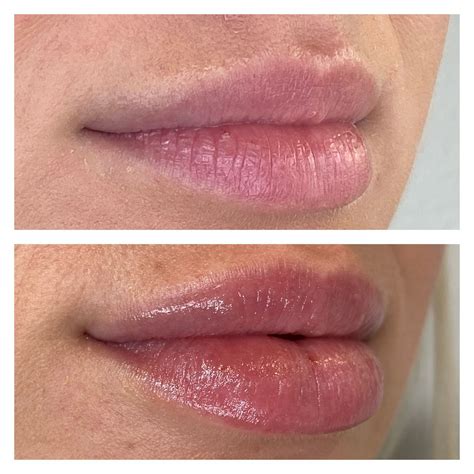 Rosealine Dawnxs: Before & After Results Will SHOCK You! Image 15