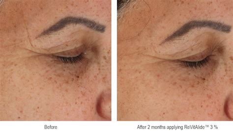 Sederma Releases ReVitAlide, an Encapsulated Version of Retinol ...