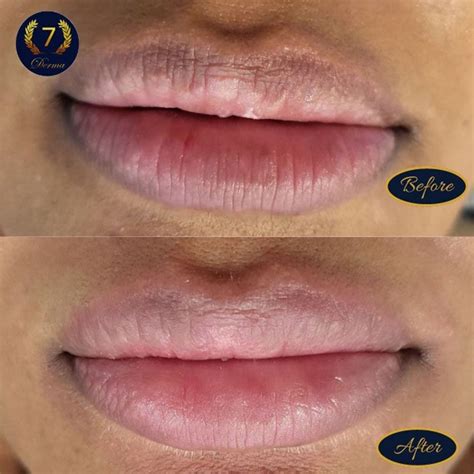 lip lightening artofit