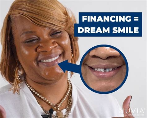 zygomatic dental implants