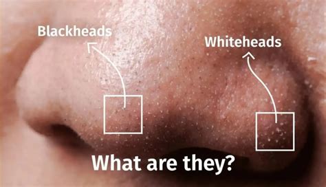 whiteheads key insights