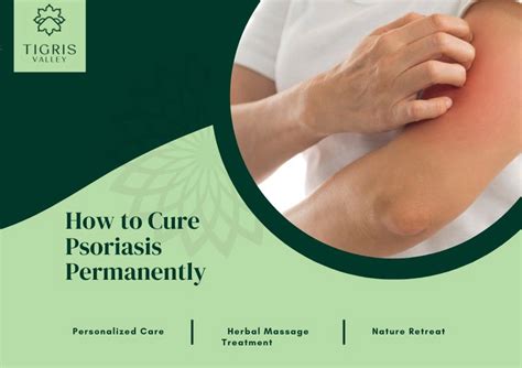 psoriasis treatment complete ayurvedic guide