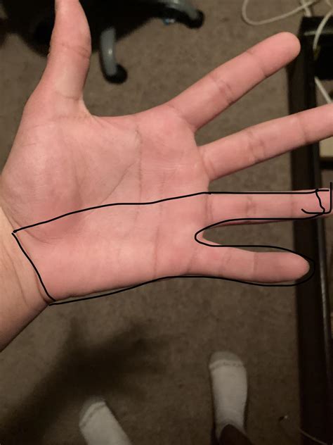 That area of my hand is always numb everyday I’m looking for some