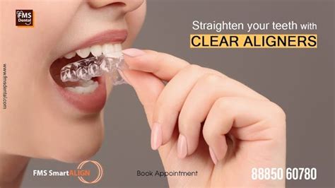 Invisible Braces, Best Dental Clinic In Hyderabad