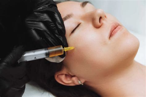 prp on face 6