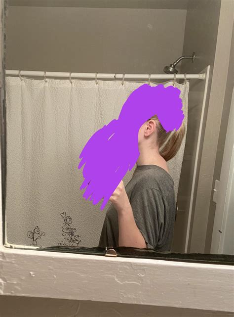 Posture issue or dowagers/Buffalo hump? : r/AdvancedPosture