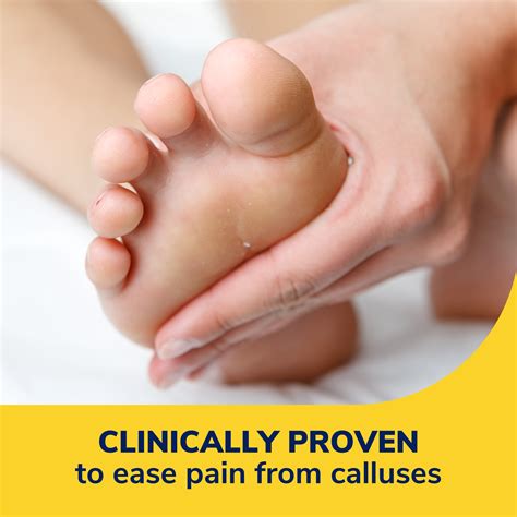 Hydrogel Callus Cushions for Pain Relief | Dr. Scholl's