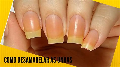 Unhas Amarelas Como Tirar