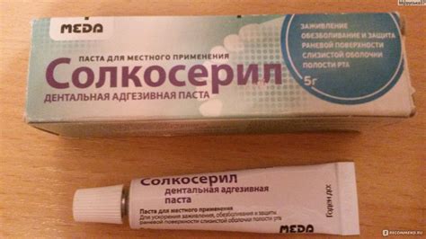 Лекарство от стоматита для детей: лучшие мази, гели, спреи и таблетки ...