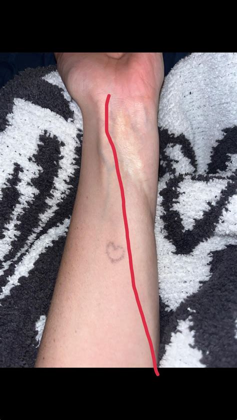 coverup with a gnarly scar : r/Tattoocoverups