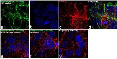 Antibodies for Immunocytochemistry (ICC) | Thermo Fisher Scientific - UK