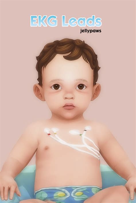 Best 12 EKG Leads – Artofit