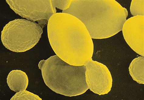 saccharomyces disease  david trumper blog