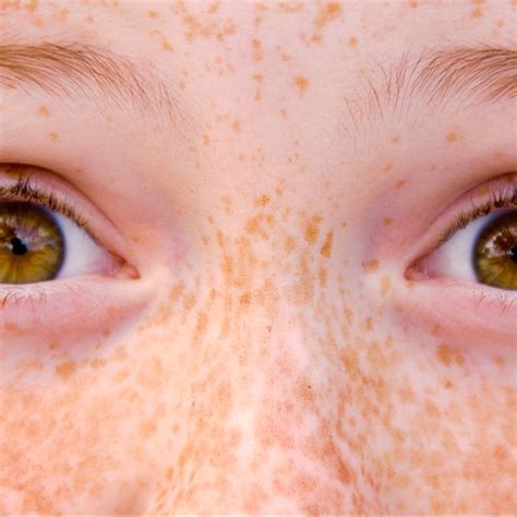 beauty  freckles exploring   names