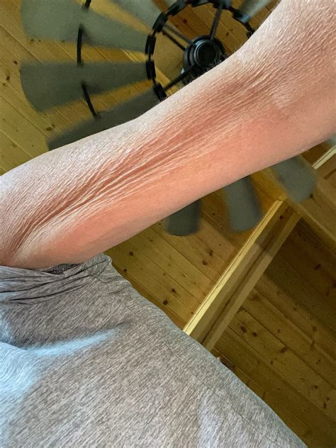 Estimated Compensation for Neurosurgeons at the Mayo Clinic 2