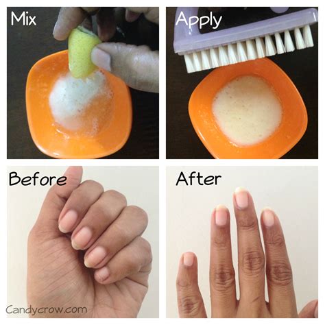 how to get rid of yellow nails
