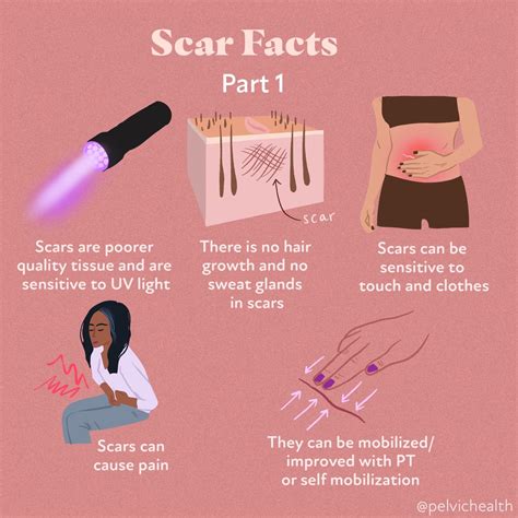 scar facts       healing phrc