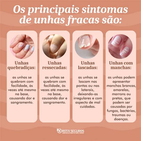 Unhas Fracas E Quebradiça - Unhas Fracas - Podem Ser Um Alerta Da Saúde